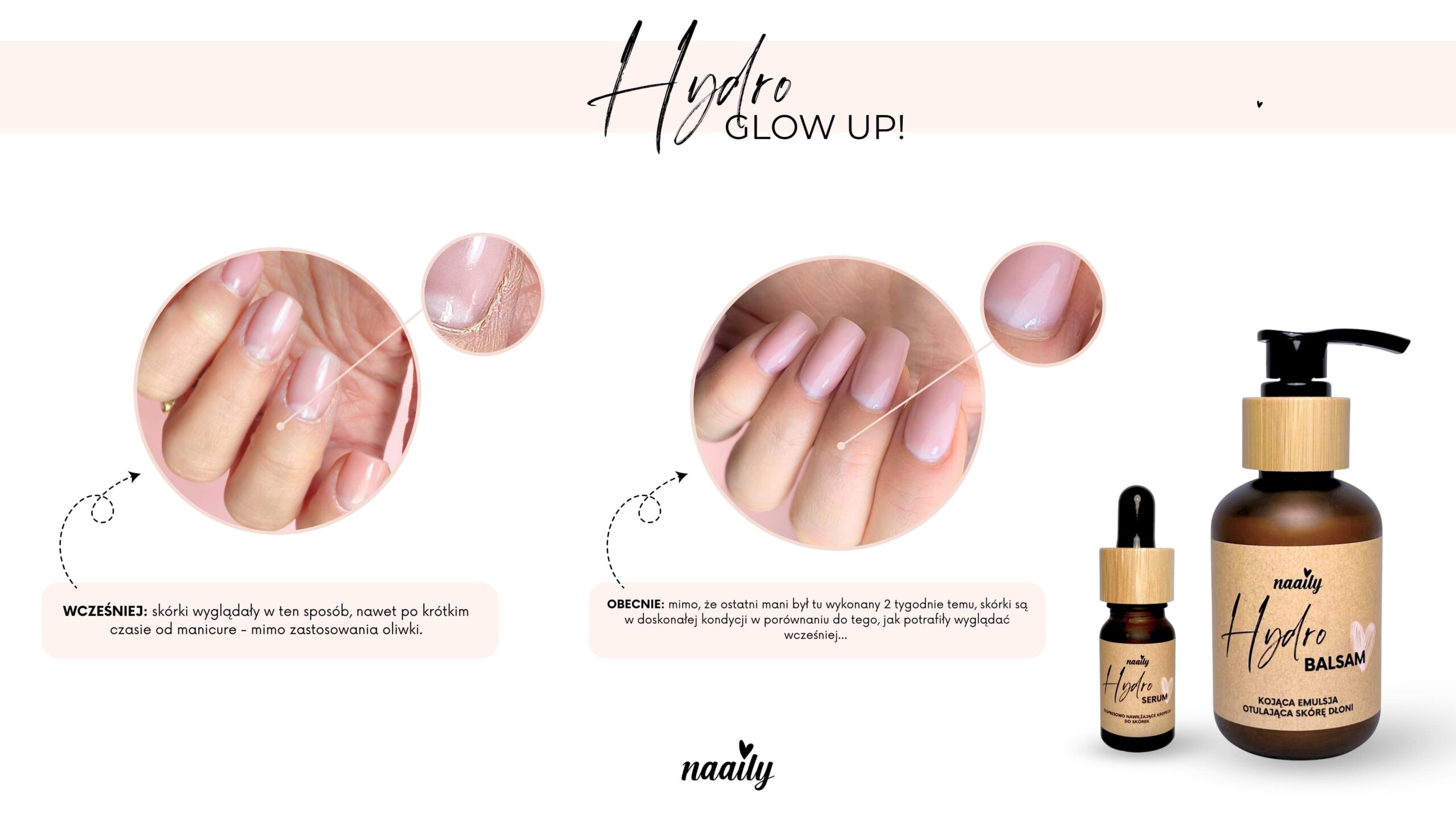 Metamorfoza skórek po używaniu zestawu Naaily Hydro Glow Up!